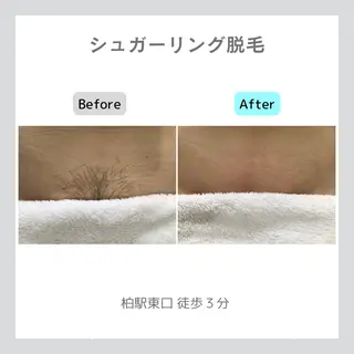 子宮矯正/腸揉み/ シュガーリング脱毛のエステ・リラクイメージ