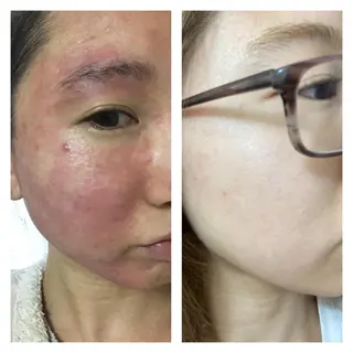 セミロング カラー パーマ ヘアアレンジ メンズ ネイル マツエク・マツパ 金の糸脱毛 産毛ケア専門のエステ・リラクイメージ