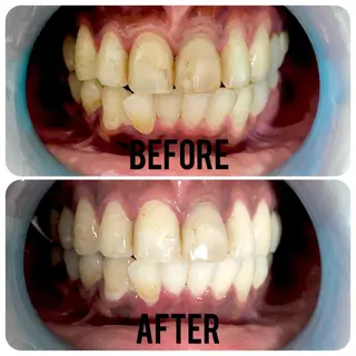 two nailのネイルデザイン