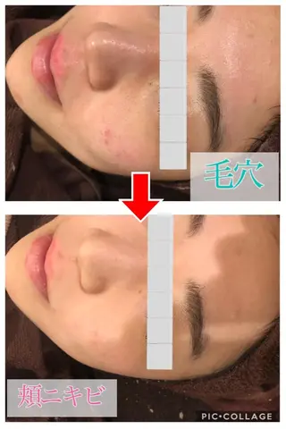 ミディアム カラー パーマ ヘアアレンジ メンズ キッズ ネイル マツエク・マツパ 金の糸脱毛 産毛ケア専門のエステ・リラクイメージ