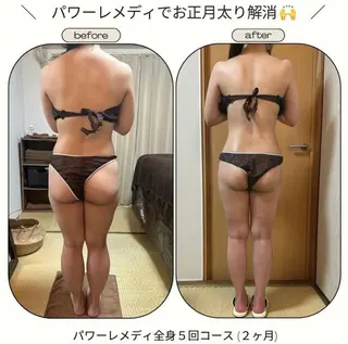 《本気痩せ×疲労改善 》  BILOOPのエステ・リラクイメージ