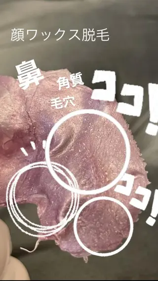 KIRAN 山﨑のエステ・リラクイメージ