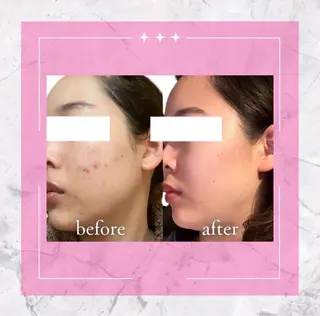 ÉTOILE所属・ÉTOILE 🌸Tomoko🌸のエステ・リラクイメージ