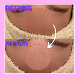 Lily luce 美骨小顔矯正のその他イメージ