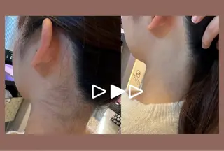 浮腫|肩こり|張り 日々の疲れを解消★のエステ・リラクイメージ