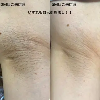DUPE&MORE 店長kanaeのエステ・リラクイメージ