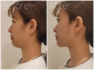 毛穴/肌管理/痩身/ ボディケア/satoのエステ・リラクイメージ