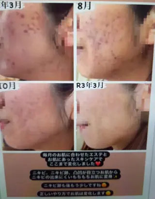 辻 恵理のエステ・リラクイメージ