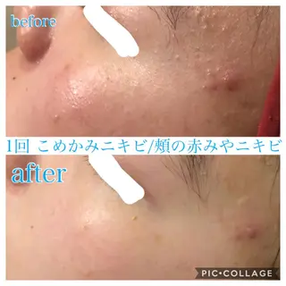 ロング カラー パーマ ヘアアレンジ キッズ ネイル マツエク・マツパ EnsorClair 代表 野口真央のエステ・リラクイメージ