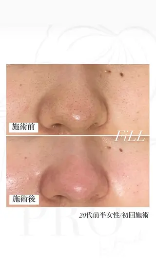 Luv the TERRACEの眉毛・アイブロウイメージ