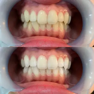 LOVE ホワイトニング新宿店のその他イメージ