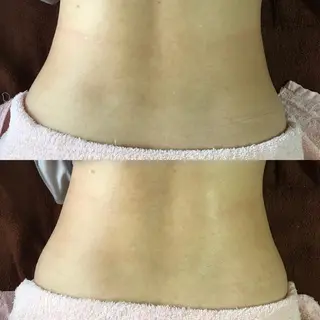 酒井 瑠未のエステ・リラクイメージ