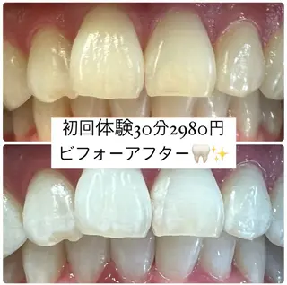 ホワイトニングルーム 横浜店のその他イメージ