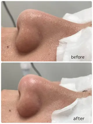 bambina KAIRIの眉毛・アイブロウイメージ