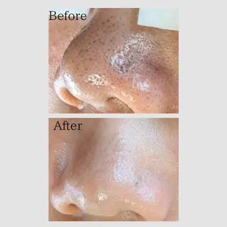 韓国肌管理 【毛穴専科】のエステ・リラクイメージ