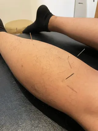 健康×美容鍼鍼灸院 あさば整体院三ノ輪店のエステ・リラクイメージ