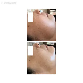 プライベートサロン Ponolaのエステ・リラクイメージ