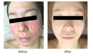 育乳&育肌 Kalmiaカルミアのエステ・リラクイメージ