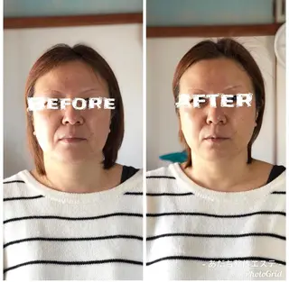 あだち整体エステ 首肩背中のゆるめぐのエステ・リラクイメージ