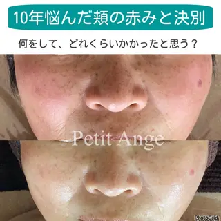 艶肌&小顔リフト❤︎ プチアンジェ茅ヶ崎のエステ・リラクイメージ