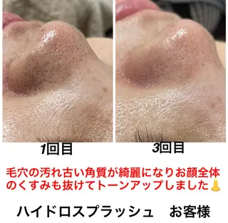 ネイル・エステサロン UILANIのネイルデザイン