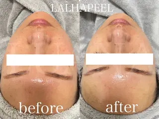 LUANA TAKAGIの眉毛・アイブロウイメージ