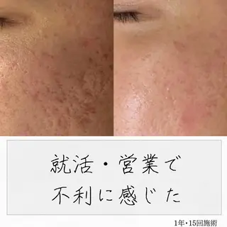 ニキビ経験者が施術 する専門サロン🌻のエステ・リラクイメージ
