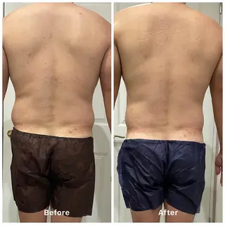 R-four🦋 土屋のエステ・リラクイメージ