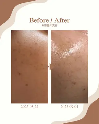 skinLabo所属・saya Mのエステ・リラクイメージ