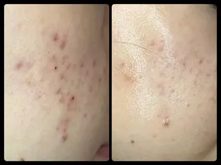 ROUN' 齋藤のエステ・リラクイメージ