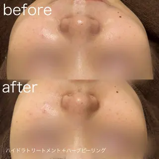 lulularico Yuのエステ・リラクイメージ