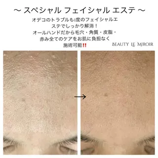 ビューティー ミロワールのエステ・リラクイメージ