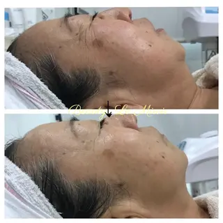 ビューティー ミロワールのエステ・リラクイメージ