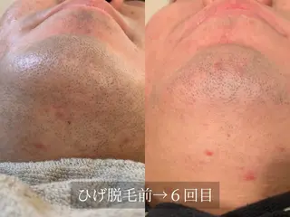 脱毛サロン Arumのエステ・リラクイメージ