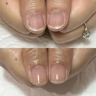 ネイル 自爪育成・巻き爪 補正講師　津蔵のネイルデザイン