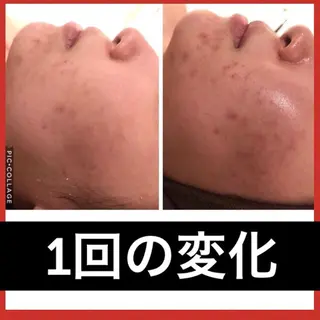 ミディアム パーマ ヘアアレンジ メンズ キッズ ネイル マツエク・マツパ ニキビ・肌質改善専門 ♡人生が変わるサロンのエステ・リラクイメージ