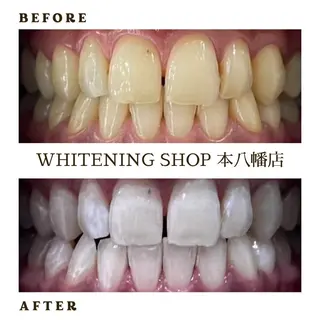 メンズ ホワイトニング ショップ本八幡店のエステ・リラクイメージ