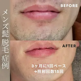 メンズ 脱毛しま専科 宗右衛門町店のエステ・リラクイメージ