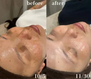 # fu♡のエステ・リラクイメージ