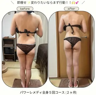 《本気痩せ×疲労改善 》  BILOOPのエステ・リラクイメージ