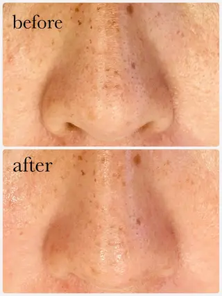 Infinity -Kayo-のエステ・リラクイメージ