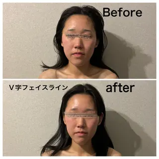 圧倒的たるみ改善 美容鍼エステのエステ・リラクイメージ