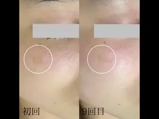 韓国美肌/肌質改善 【天神】のエステ・リラクイメージ