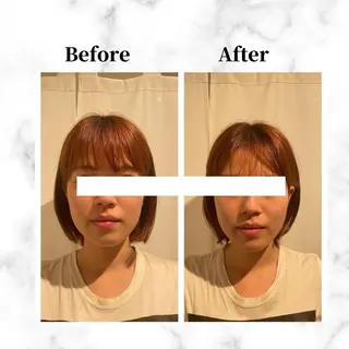 12Dハイフ💗 最強小顔のエステ・リラクイメージ