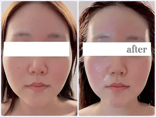 Anjir(アンジール)所属・完全個室サロン Anjirのエステ・リラクイメージ