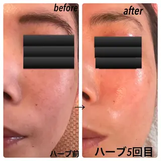 fairyrose organicエステのエステ・リラクイメージ