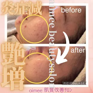 肌質改善サロン aimee｜アイミーのエステ・リラクイメージ