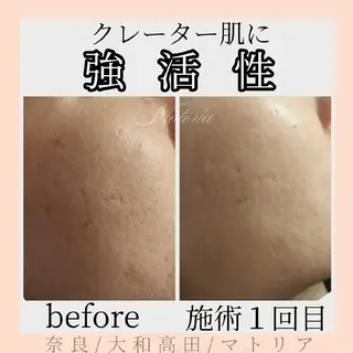 小顔 美肌専門 Matoriaのエステ・リラクイメージ