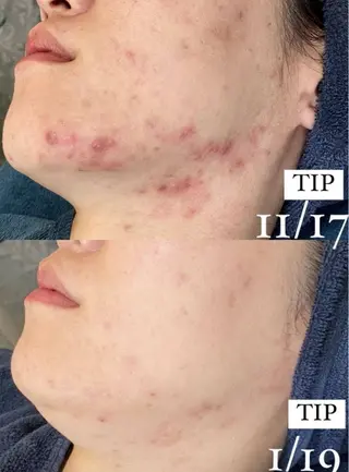 Ellebeauty relaxationのエステ・リラクイメージ