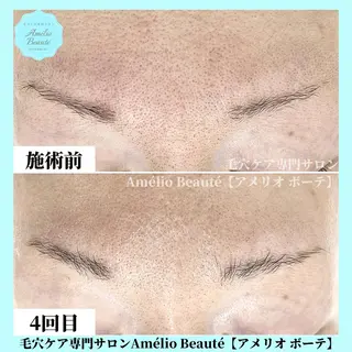 毛穴ケア専門サロン アメリオボーテのその他イメージ